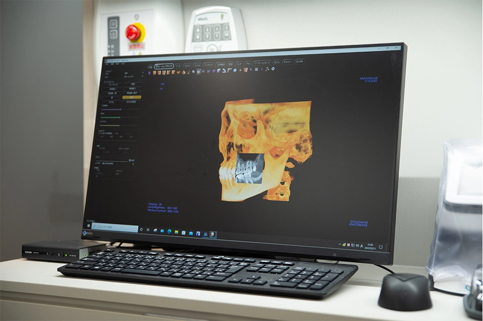 歯科用CT・X線システム